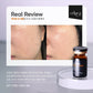 Caviel-52 | 1 Box * 8 Ampoules | 5 mL / ea